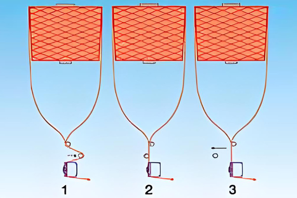 Automatic Yarn Tension Control